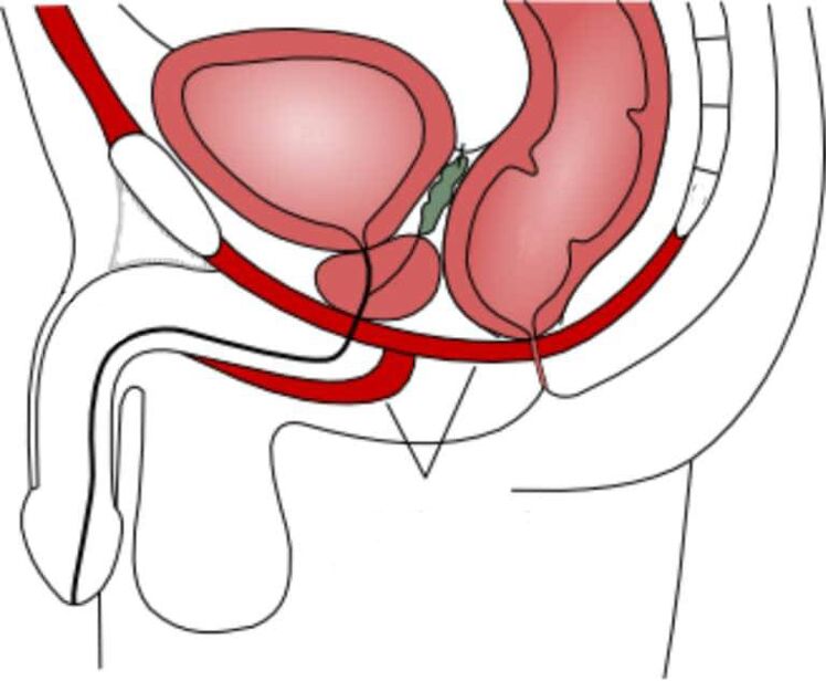 Entrenar los músculos del suelo pélvico para mejorar la potencia.